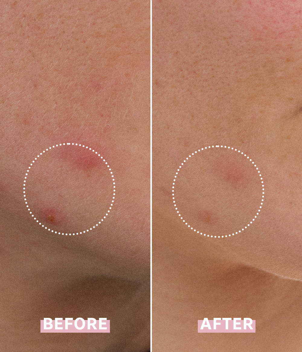 OH MY CICA SPOT GEL CREAM - CAIA Cosmetics